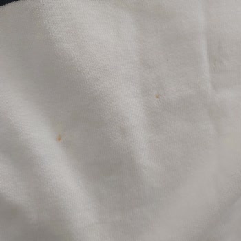 Aldığım T-shirtlerde Pas Lekesi Var, İade Kabul Edilmedi