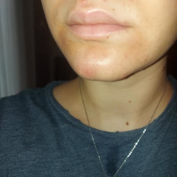 Bioderma Sensibio Yüz Yıkama Jeli Cildimi Kötüleştirdi