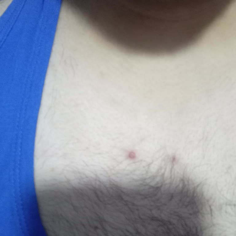 Herbalife Ürünlerinde Yaşadığım Yan Etkiler Ve Maddi Kayıplar