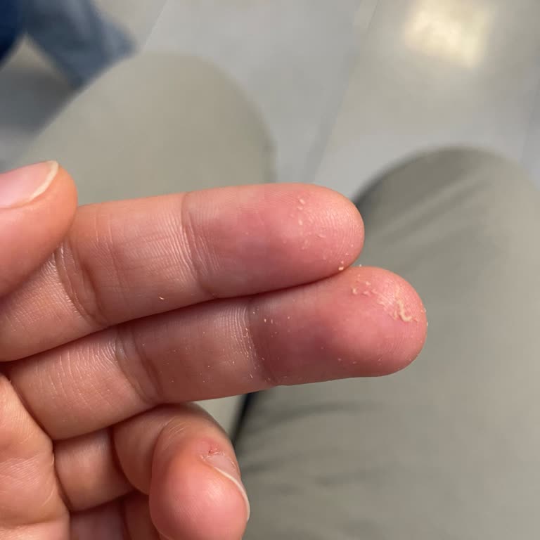 Bozulan Güneş Kremi İçin Çözüm Bulamıyorum