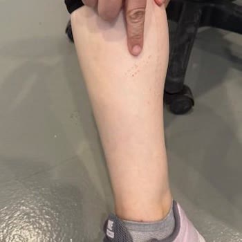 Özel Sağlık Sigortam Aynı Şikayetimi Bu Kez Karşılamadı, Mağdur Edildim
