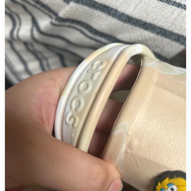 Bir Günlük Crocs Terlikte Şişme Sorunu Ve İlgisiz İnceleme Süreci