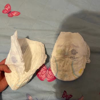 Molfix Dört Numara Külot Bezlerde Yırtık Sorunu