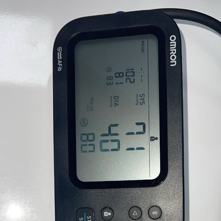 Tansiyon Aleti Yanlış Ölçüm Yapıyor Firma Dönüş Yapmıyor