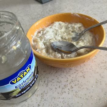 Aldığım Üründe Solucan Çıktı, Hijyen Sorunu Var