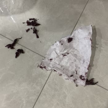 Kurutma Makinesi Tüy Bırakıyor Servis Ve Müşteri Hizmetleri Çözüm Sunmuyor