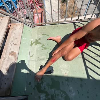 Su Kaydırağı Merdiveninde Yaşanan Güvenlik Sorunu Ve Yetersiz İlk Yardım