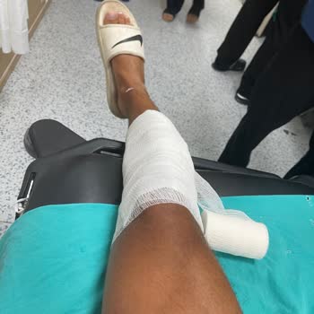 Su Kaydırağı Merdiveninde Yaşanan Güvenlik Sorunu Ve Yetersiz İlk Yardım