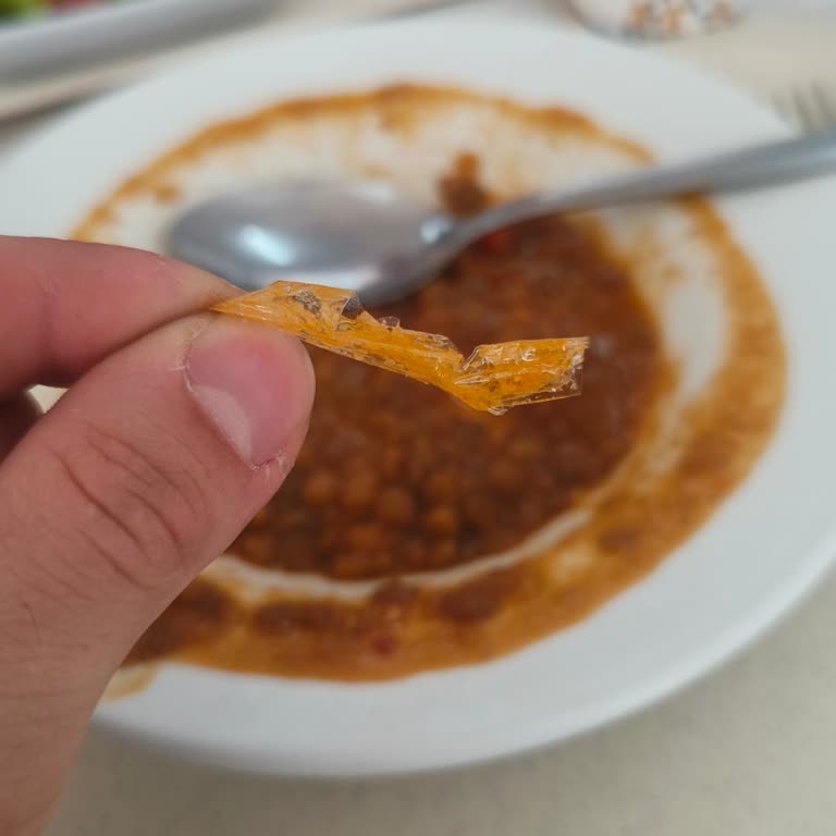 Yemekte Yabancı Cisim Buldum Şaşkınım