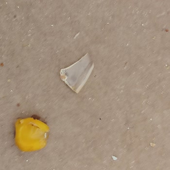 Pizzadan Çıkan Cam Parçası Küçük Çocuğumun Hayatını Tehlikeye Attı