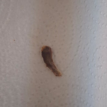 Lezita Hazır Dönerde Kemik Parçası Şoku Ve Hayal Kırıklığı