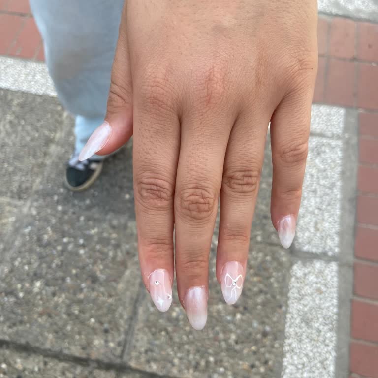 Tırnak İşleminde Beklentilerin Karşılanmaması Ve İlgisizlik