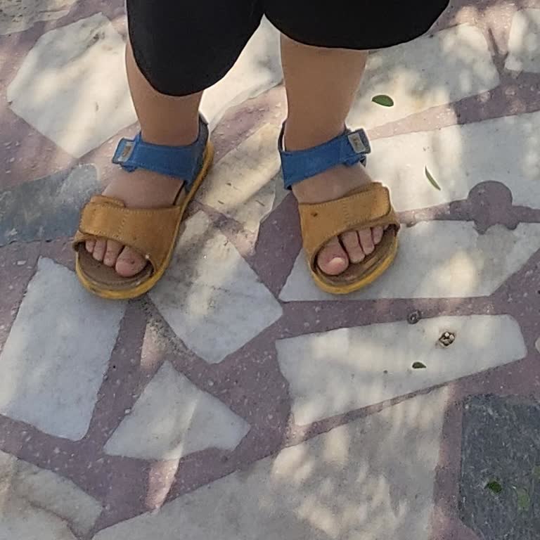 Sandalet Renk Solması Ve Ayakta Leke Sorunu