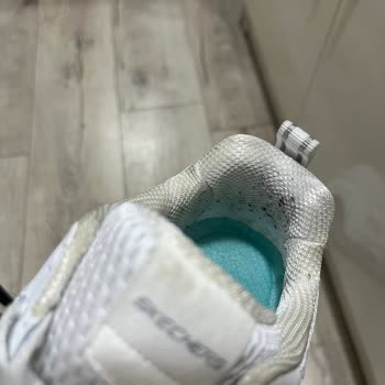 Skechers Ayakkabıda Hızlı Deformasyon Ve Yetersiz Çözüm