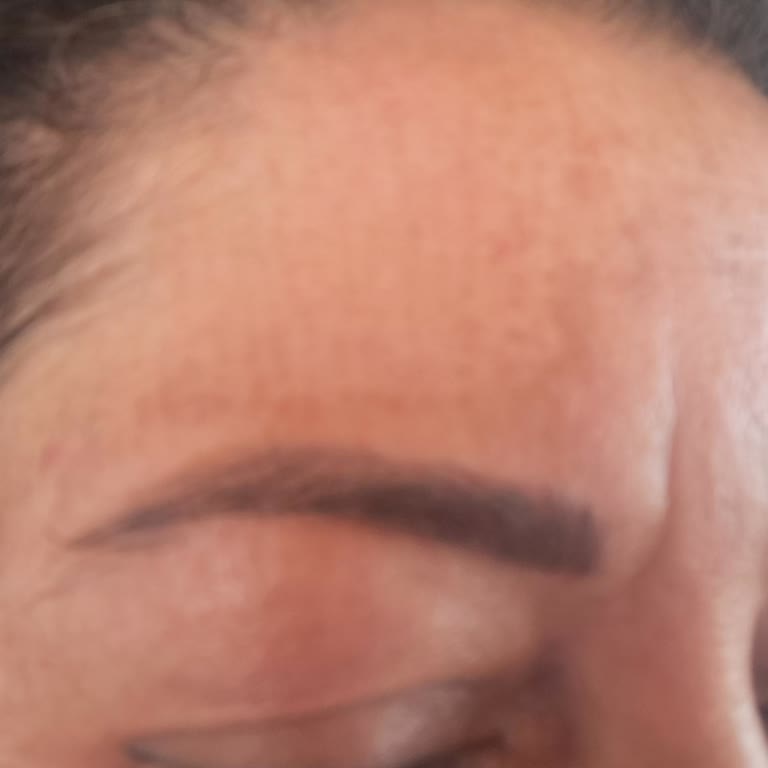 Yanlış Yönlendirme Ve Başarısız İşlem Sonucu Cilt Sorunlarım Arttı