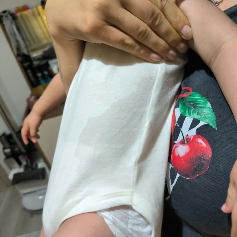 Molfix Bezlerde Son Üretimde Aşırı Sızdırma Sorunu Yaşanıyor