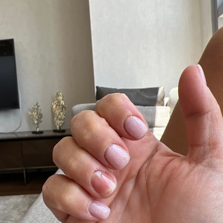 Kötü Müşteri Deneyimi Ve Kalitesiz Hizmet