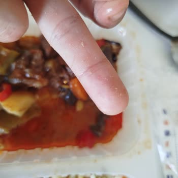 Siparişimde Hijyen Sorunu Ve Müşteri Hizmetlerine Ulaşamama