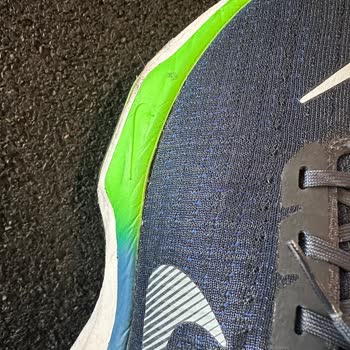 Ayakkabı Kusurunda Çözüm Yerine Suçlama Ve İlgisizlik!