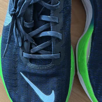 Ayakkabı Kusurunda Çözüm Yerine Suçlama Ve İlgisizlik!