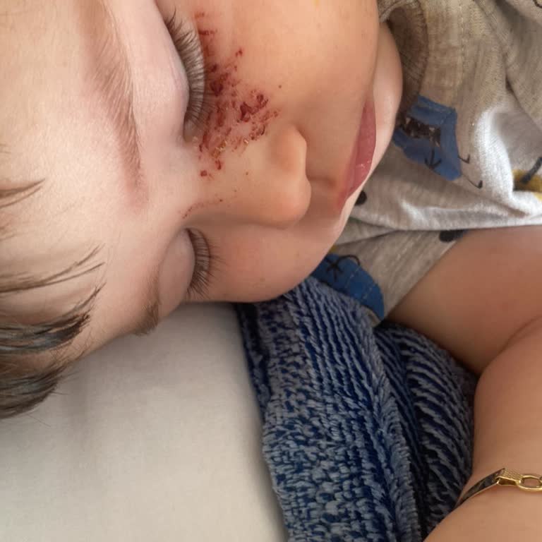 Проблема безопасности Globber велосипеда, нет поддержки