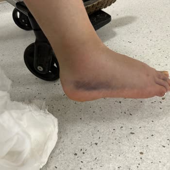 Acil Durumda İlgisiz Ve Kaba Doktor Mağduriyeti