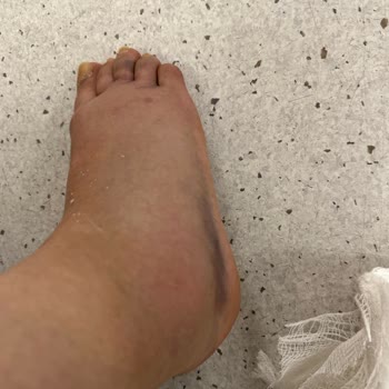 Acil Durumda İlgisiz Ve Kaba Doktor Mağduriyeti