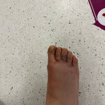 Acil Durumda İlgisiz Ve Kaba Doktor Mağduriyeti