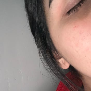 Aldığım Kaş Ve Kirpik Serumu Cildimde Olumsuz Sonuçlara Yol Açtı