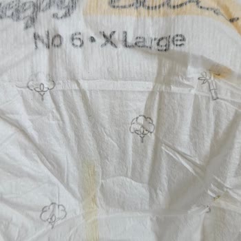 Sleepy 6 XL Bebek Bezi Beklenenden Küçük Çıktı