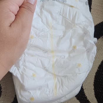 Sleepy 6 XL Bebek Bezi Beklenenden Küçük Çıktı