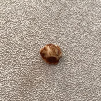 Carrefour SA Pastasında Taş Çıkması Küçük Çocuğum Tehlike Atlattı