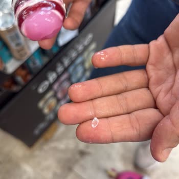 Dondurmanın İçinden Cam Çıkmasıyla Yaşanan Tehlike