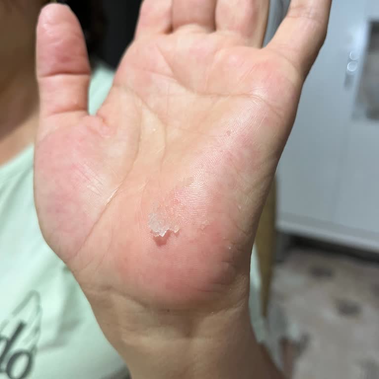 Bebek Bezinde Şeffaf Jel Benzeri Maddeyle Karşılaştım, Sağlık Endişesi Yaşıyorum