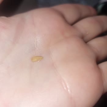 Eti Lifalif Yulaf Barında Kılçık Tehlikesi Ve Sağlık Riski