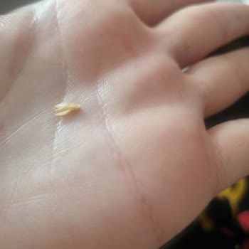 Eti Lifalif Yulaf Barında Kılçık Tehlikesi Ve Sağlık Riski