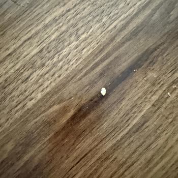 Yemekteki Kemik Parçası Nedeniyle Dişim Kırıldı, Mağduriyetim Giderilsin