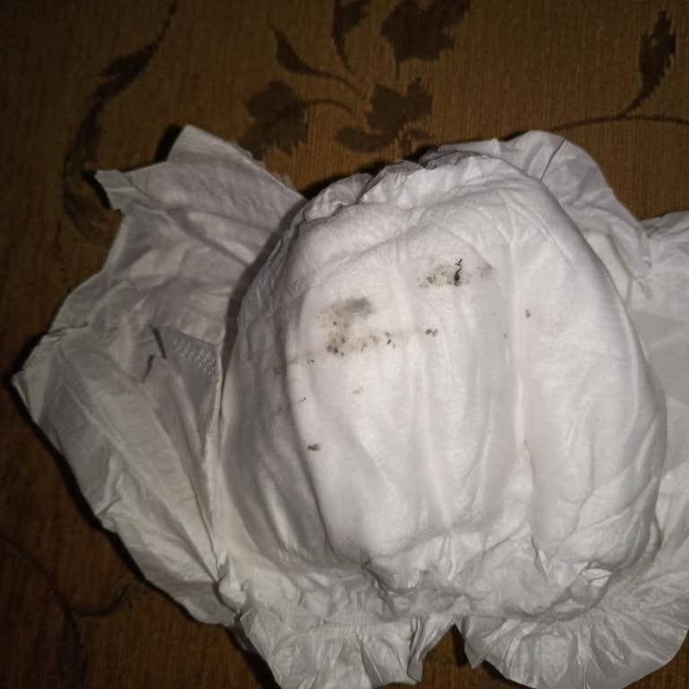 Bebek Bezinde Ezilmiş Böcek Benzeri Yabancı Madde Şoku