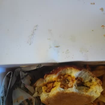 Yemekten Metal Tel Çıktı, Sağlığım Tehlikeye Girdi!