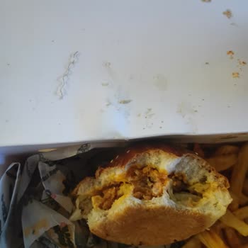 Yemekten Metal Tel Çıktı, Sağlığım Tehlikeye Girdi!