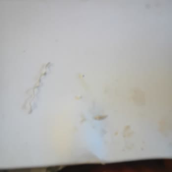 Yemekten Metal Tel Çıktı, Sağlığım Tehlikeye Girdi!