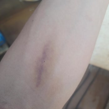 Özel Mercan Hastanesi Kolumu Mahvetti