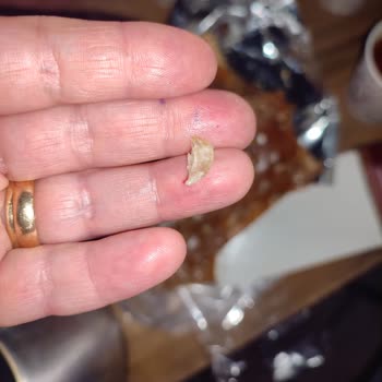 Aldığım Üründen Yabancı Cisim Çıktı Şaşkınım