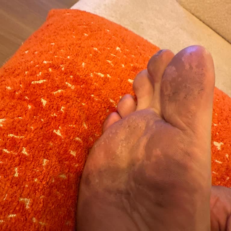 Aldığım Terliklerin Kalitesizliği Ve Değişim Sürecindeki Mağduriyet