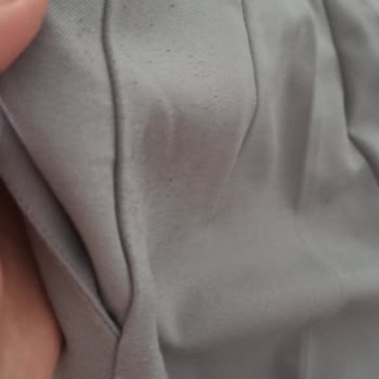 Kısa Sürede Tüylenen Pantolonun İadesi Haksız Şekilde Reddedildi