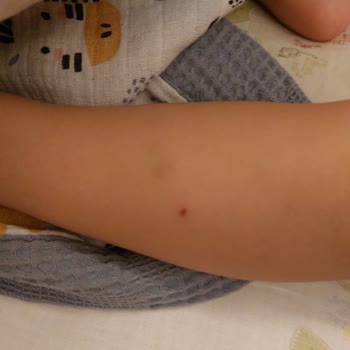 Raid Sıvı Sivrisinek Makinesi Çocuğumu Sivrisineklerden Koruyamadı