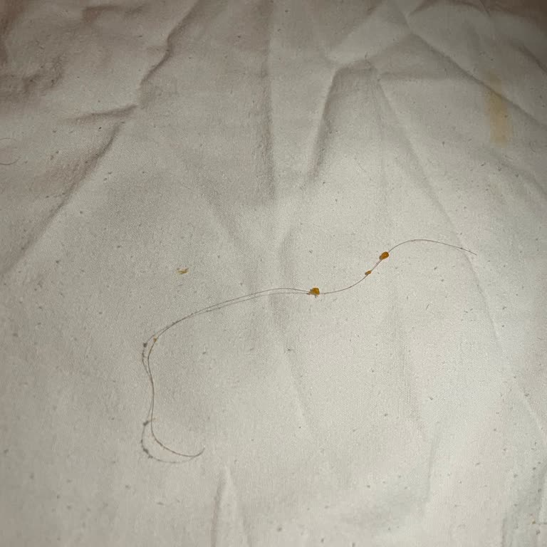 Cipsin İçinden Saç Çıkmasıyla Hayal Kırıklığı Yaşadım