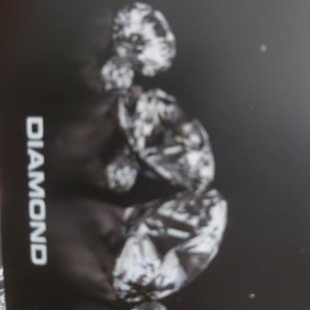 Diyarbakır'da Satın Alınan Yüzükte Yaşanan Sorunlar ve Mağduriyet