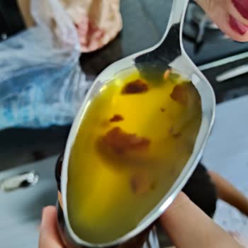 Aldığım Üründe Parça Sorunu Ve Güvensizlik Yaşadım