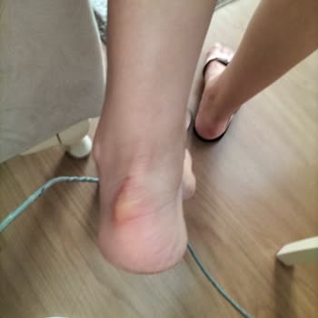 Skechers Ayakkabıda Arka Astar Sorunu Ve İade Reddi
